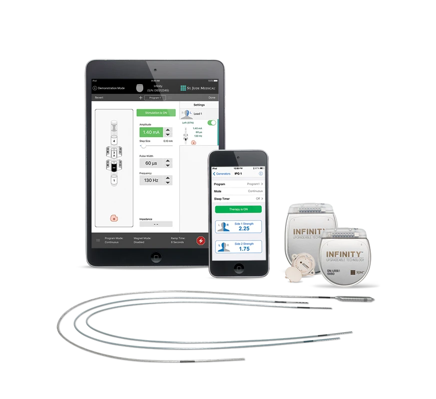 Directional leads and extensions